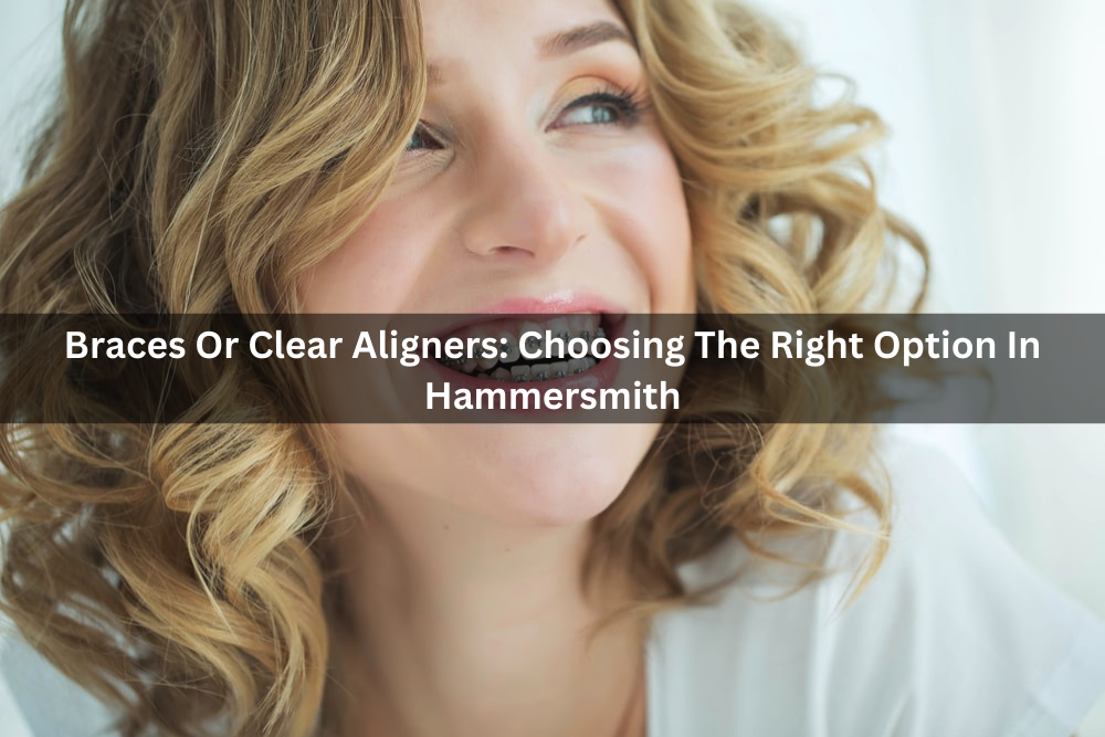 Braces Or Clear Aligners: Choosing The Right Option In Hammersmith
