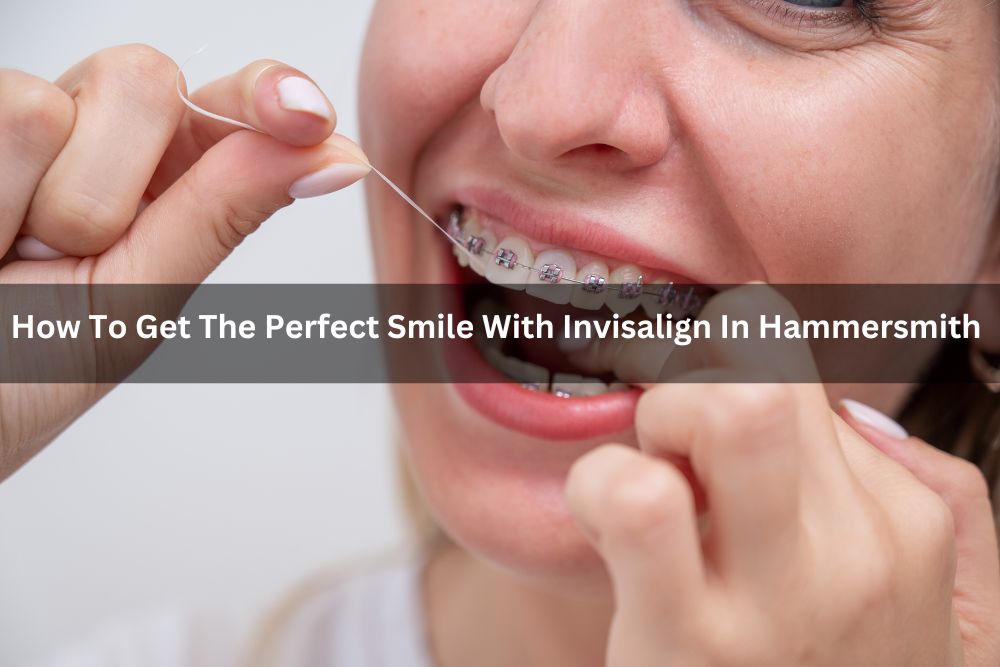How To Get The Perfect Smile With Invisalign In Hammersmith