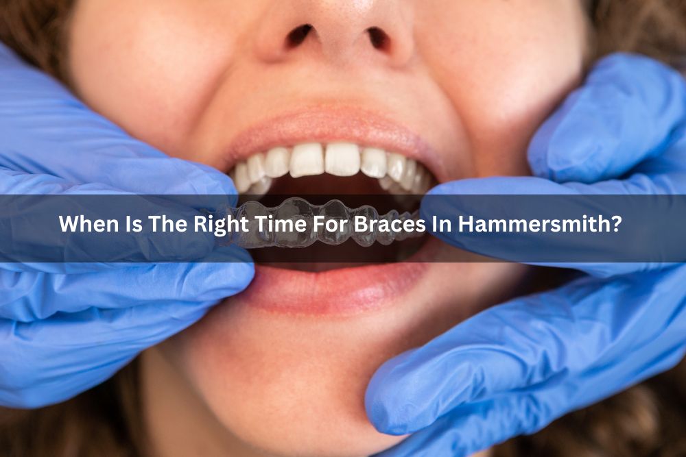 When Is The Right Time For Braces In Hammersmith?
