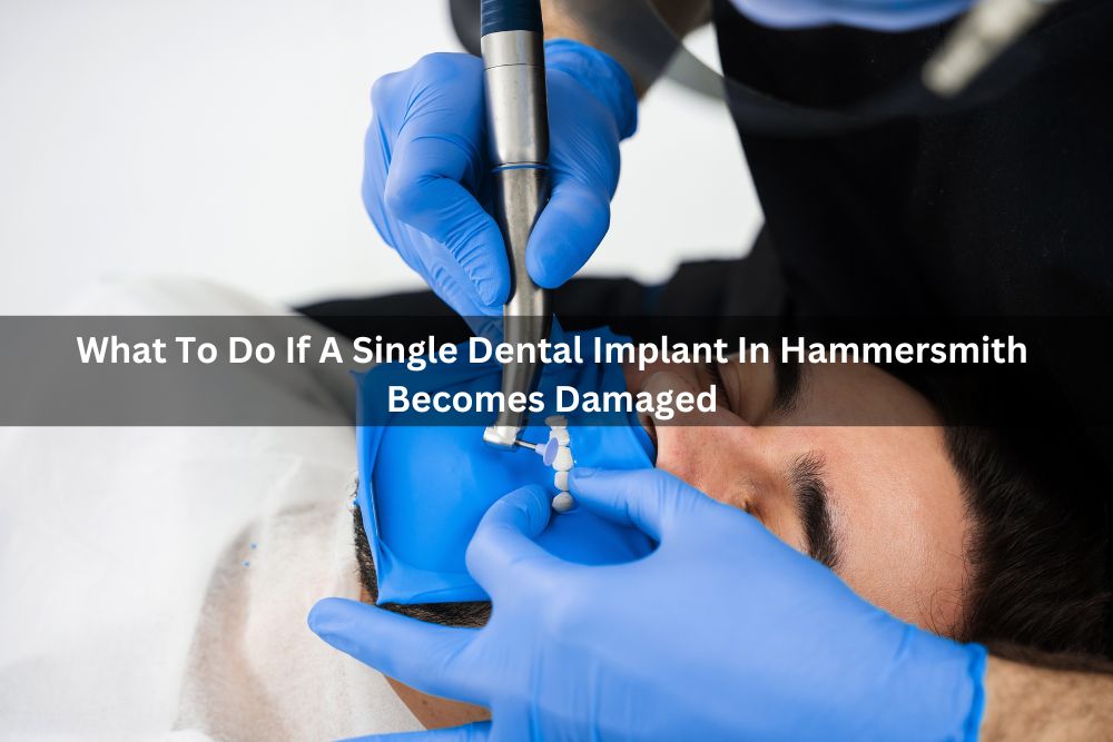 What To Do If A Single Dental Implant In Hammersmith Becomes Damaged