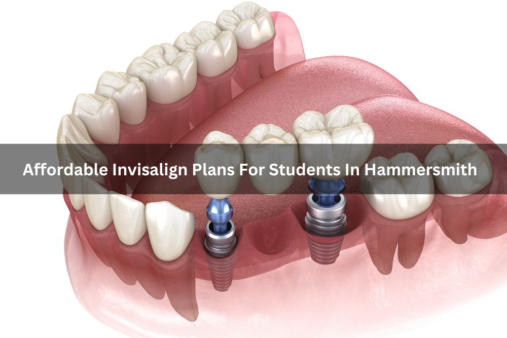 Affordable Invisalign Plans For Students In Hammersmith